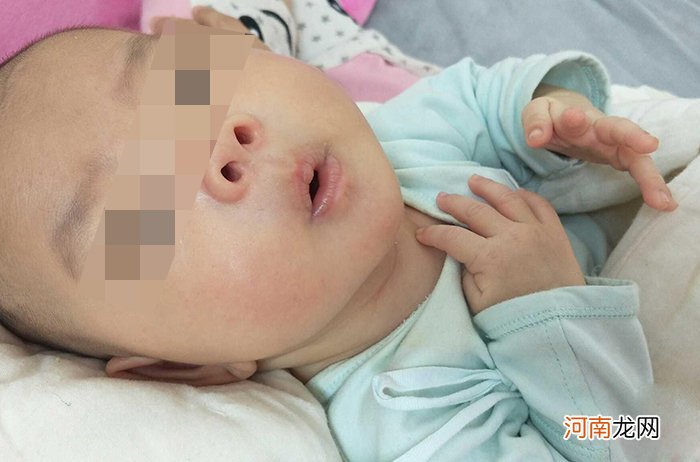 刚出生的宝宝太丑？如果是这4个部位，将来颜值会很高，不用担心