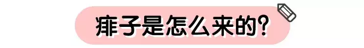 宝宝长痱子怎么办 婴儿起痱子怎么快速解决