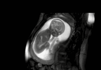胎儿在肚里传递的4个信号，孕妈接收到几个？越多说明宝宝越聪明