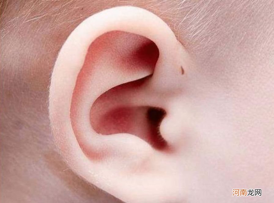 为啥有些孩子耳朵有“小孔”？和命运没关系，医生告诫不能大意