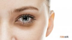 黑眼圈严重的原因 什么原因导致的黑眼圈