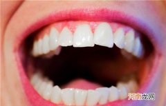 怎么缓解牙龈出血 牙齿出血的因素有哪些
