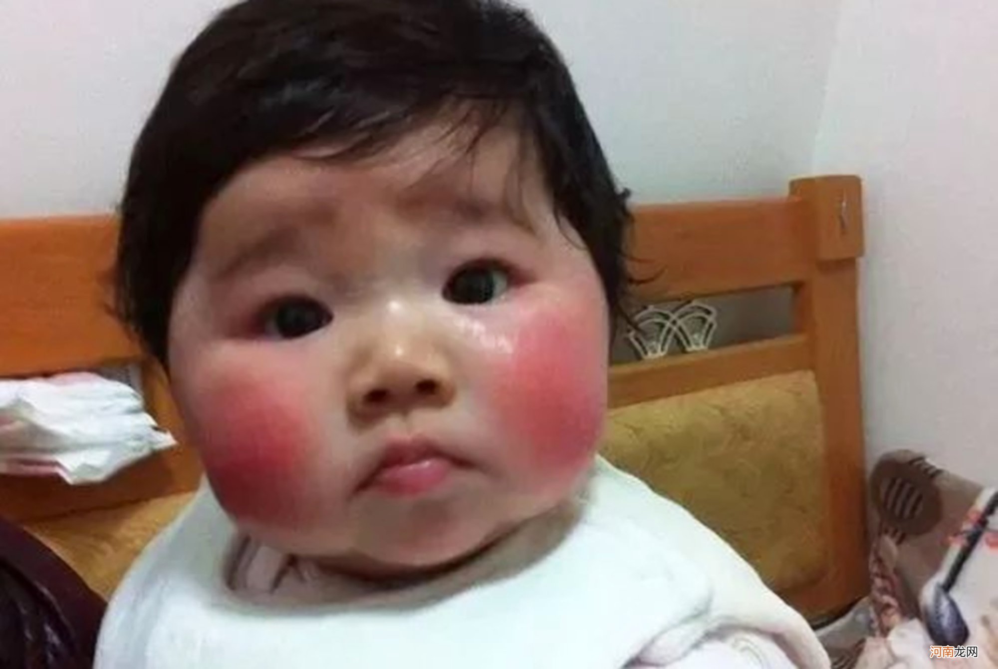 “红脸蛋”的宝宝很可爱？皮肤冻伤不容忽视，护理好才能白里泛红