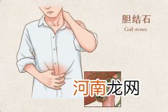 胆结石吃什么好 哪些食物有利于胆结石患者