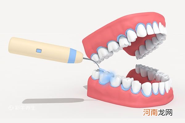 洗完牙齿多久能吃东西 洗完牙齿后的注意事项