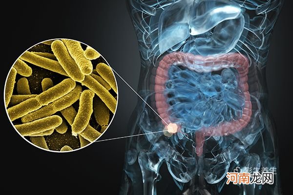 肠炎与肠癌最明显区别 肠炎与肠癌的区别有哪些
