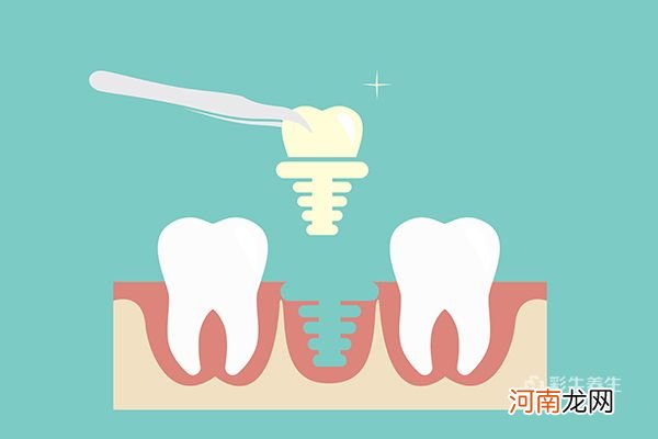 拔牙的危害有多大 拔牙有哪些危害