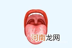 舌头上溃疡怎么治 怎么治疗舌头上的大溃疡