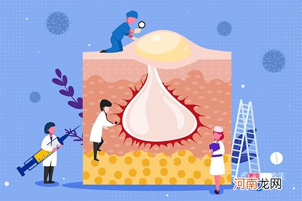 闭口是什么意思 闭口是什么东西