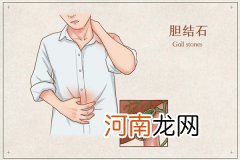 胆结石不能吃哪些东西 胆结石发病原因