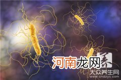 大肠杆菌菌落特征 大肠杆菌菌落特征大小
