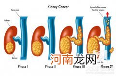 人的肾脏在哪个位置 人的肾脏在什么位置?