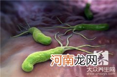 大肠杆菌是什么生物大肠杆菌是什么生物?是原核还是真核生物