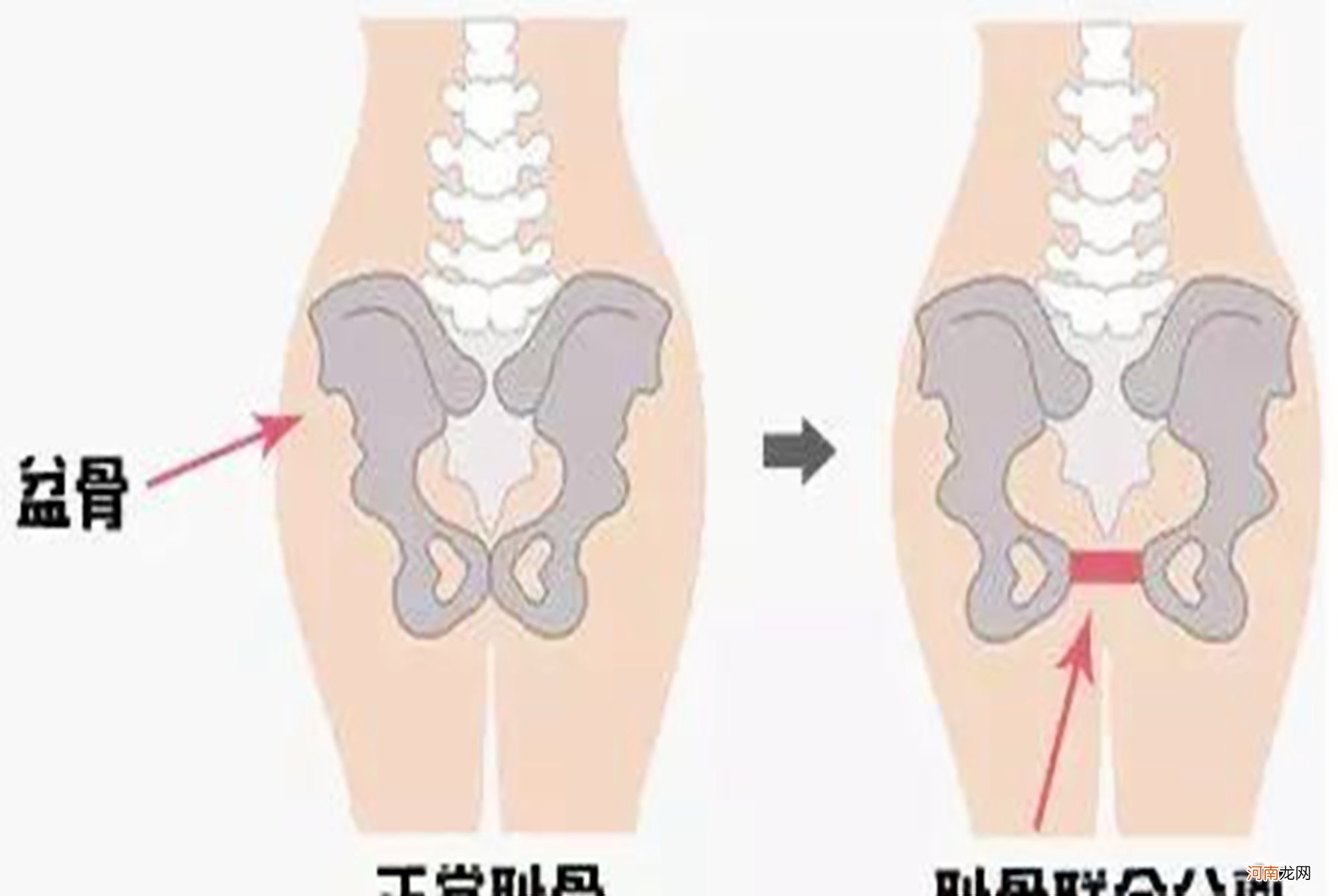 孕晚期有一种难熬的痛，痛到“怀疑人生”，容易找上这4类孕妈