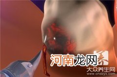 乳腺囊肿最佳治疗方法是什么？ 乳腺囊肿需要治疗吗怎样治疗