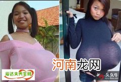 丁嘉芬资料 中国首位吉斯尼纪录巨胸女孩饱受旁人侧目