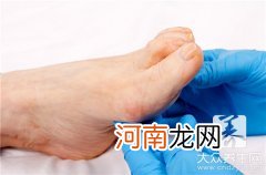 脚肿是什么病的前兆 男人脚肿是什么病的前兆