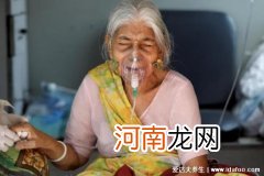 印度爆发的毛霉菌什么样子 印度爆发的毛霉菌感染症状图片