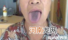 胃癌早期舌头图片舌诊 胃癌早期舌头图片