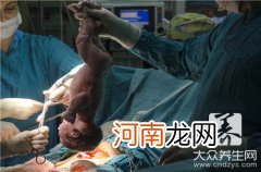 正常的剖腹产疤痕图片 正常的剖腹产疤痕图片一个月后