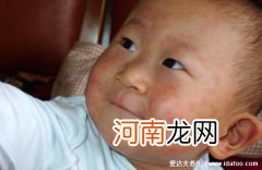 婴幼儿急疹图片初期症状图片 幼儿急疹图片初期症状图