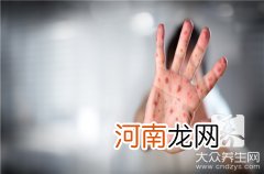 风疹病毒抗体igg过高是什么意思？ 抗风疹病毒抗体igg高是什么意思