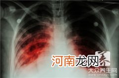 微创要多少费用 微创费用大概需要多少