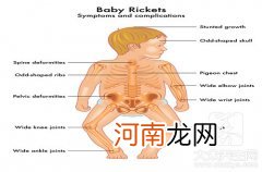 18三体综合症高风险 18三体综合症高风险是什么原因引起的