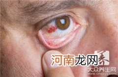 常见眼病诊断图谱 常见眼科疾病图谱