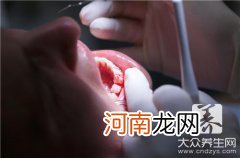 牙周炎的典型症状 单纯性牙周炎症状是什么？