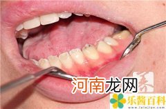 牙裂是什么原因导致的 牙裂怎么办