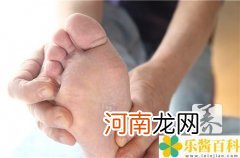 脚跟起皮干裂怎么回事  脚后跟干裂起硬皮怎么回事