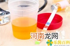 载脂蛋白b偏低是什么意思 载脂蛋白a1偏高是什么意思