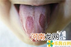 舌头发黑警惕四种病 舌头上发黑是什么原因