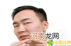 哪里治痤疮便宜又好 那里治疗痤疮好