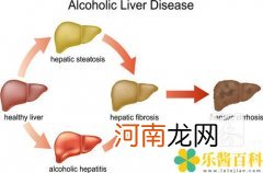 肝脾综合征名词解释  肝肺综合征名词解释