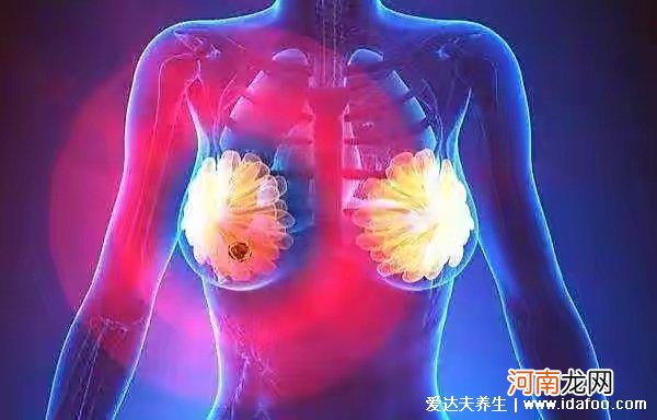 乳腺增生疼起来只能挺？如何缓解？