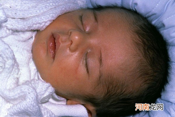 不想宝宝出生后被黄疸“找上门”,孕期孕妈坚持“三不做”很关键