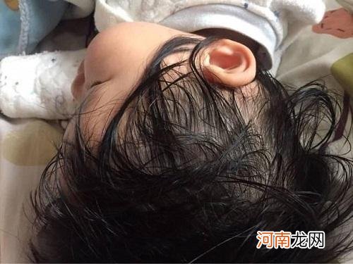 夏季炎热，孩子这三个地方常出汗，很可能是缺钙，宝妈别掉以轻心