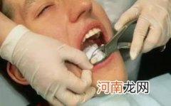 儿童拔牙有什么危害优质