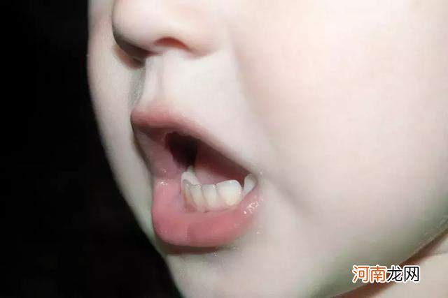 孩子长时间用嘴呼吸，长相会变丑吗？看看研究调查结果显示