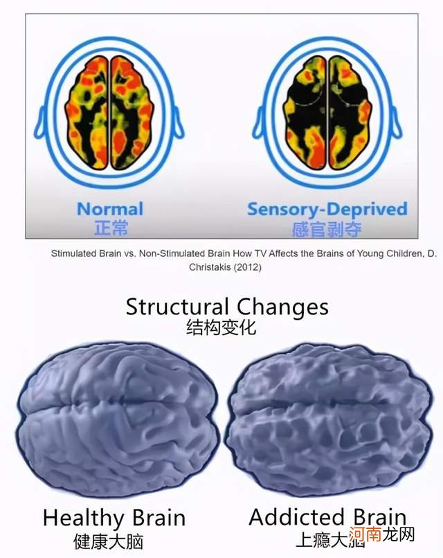 脑神经专家：3岁前看电视和不看电视的孩子，差距在7岁开始出现