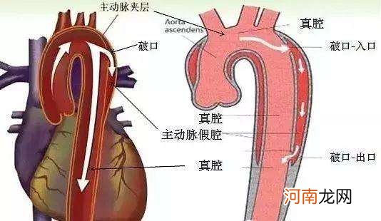 世界上最可怕的绝症是什么 世界五大绝症