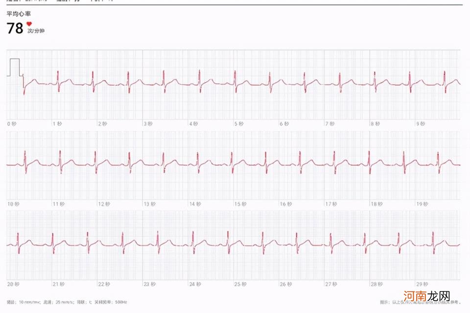 华为gt2pro手表功能介绍，ECG版收费功能体验？