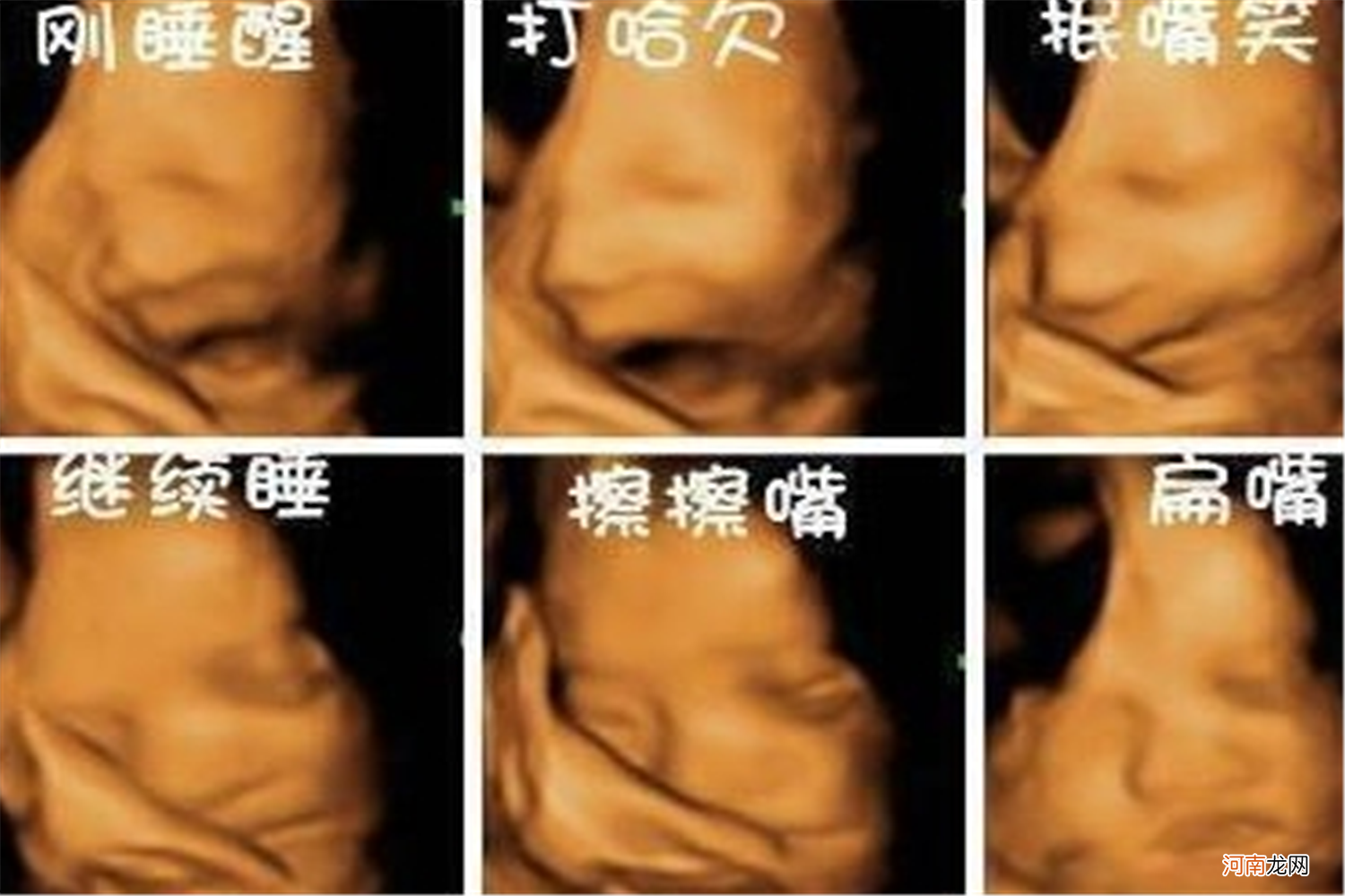 孕期如何判断胎儿是否聪明，看这3处细节就知道，全占的恭喜了