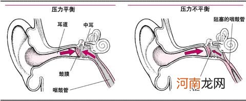 下飞机后耳朵听不清了怎么办 下飞机后一只耳朵聋了怎么办