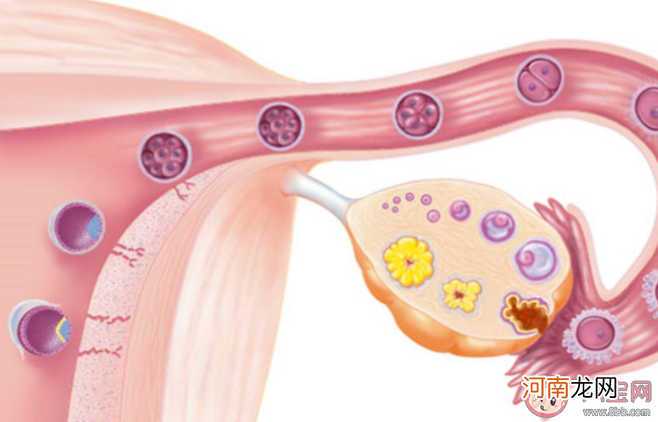 孕期|孕期卵巢肿瘤胎儿还能留吗 孕期手术对胎儿有影响吗