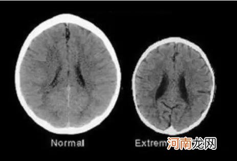 为啥孩子被吼后不说话，还反过来求抱抱，知道真相后你还敢吼吗？