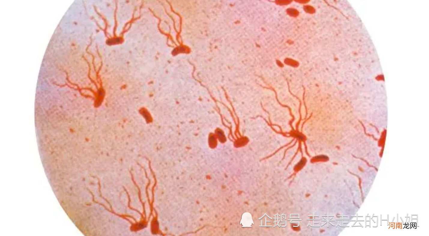 美国23个州暴发沙门氏菌疫情，儿童老人更易感染