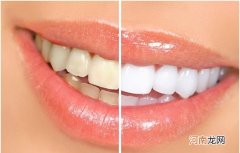 美白牙齿最有效的方法 牙黄变白最实用的方法